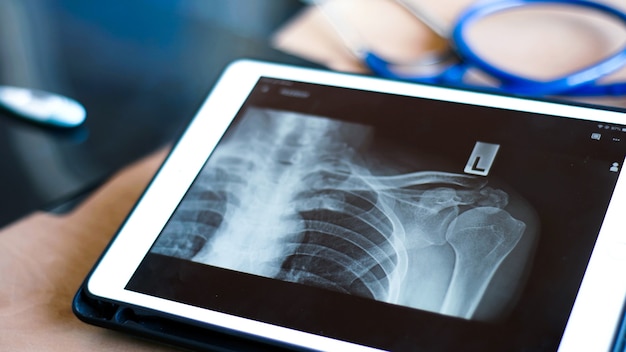 Dokter gebruikt een slim apparaat voor het bekijken van röntgenfoto's en diagnose voor snelle bestelling, telegeneeskundeconcept