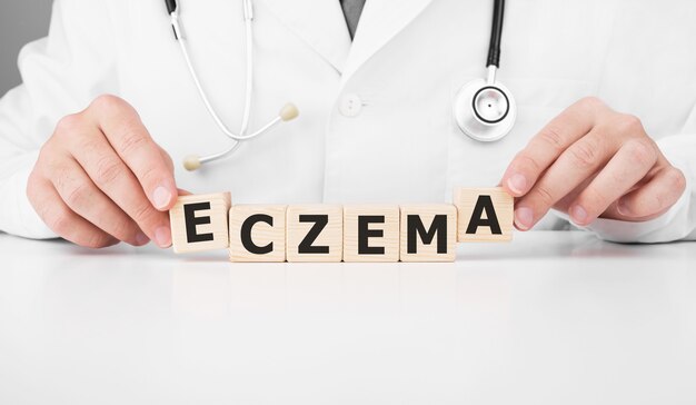 Dokter houdt houten kubussen in zijn handen met tekst ECZEMA