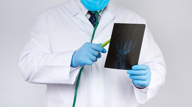 Dokter in een witte jas en blauwe latex handschoenen houdt een röntgenfoto van de hand van een man