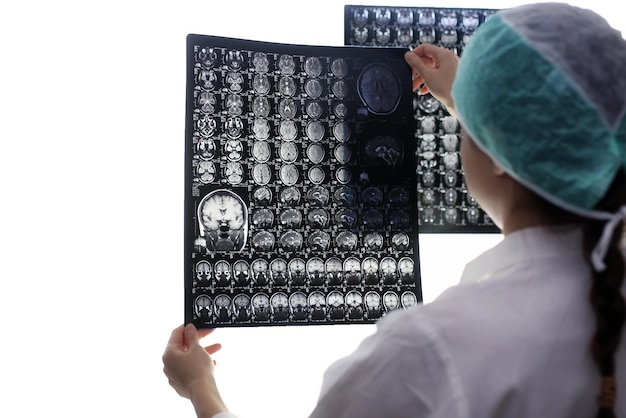 Foto dokter met een foto van een hersen-mri-workflow in een diagnostisch ziekenhuis