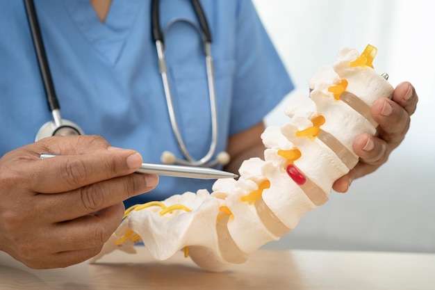 Dokter met lumbale wervelbeenskelet en zenuwmodel voor behandeling in de orthopedische afdeling