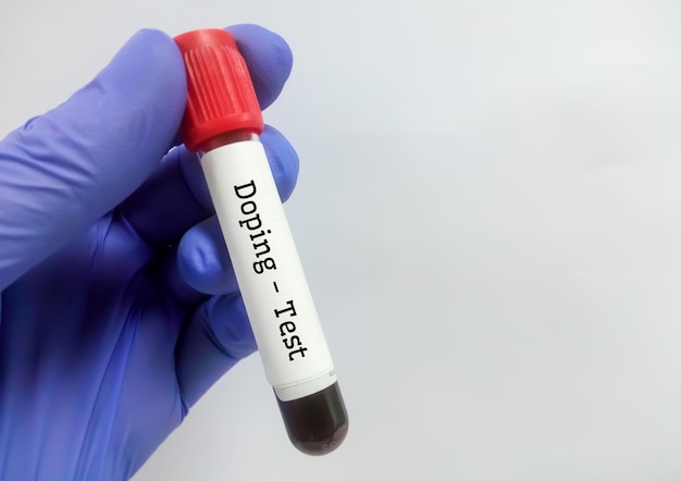 Dokter met reageerbuis met bloedmonster voor dopingtest