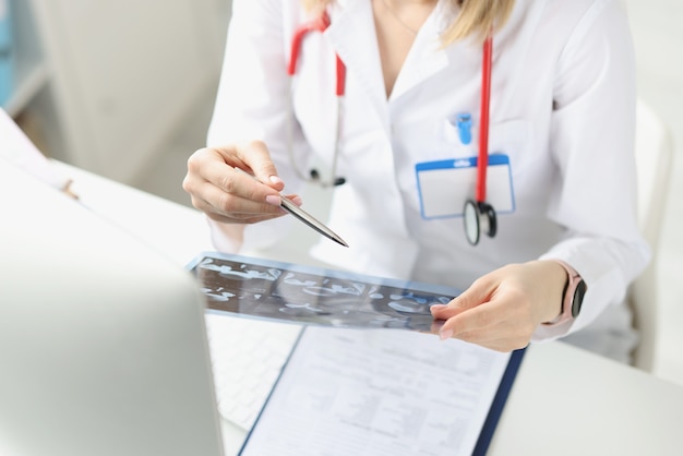 Dokter onderzoekt röntgenfoto van patiënt aan werktafel