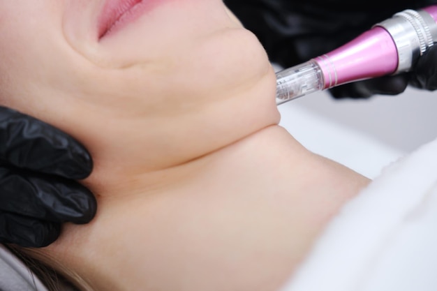 Double chin removal with mesotherapy Close up