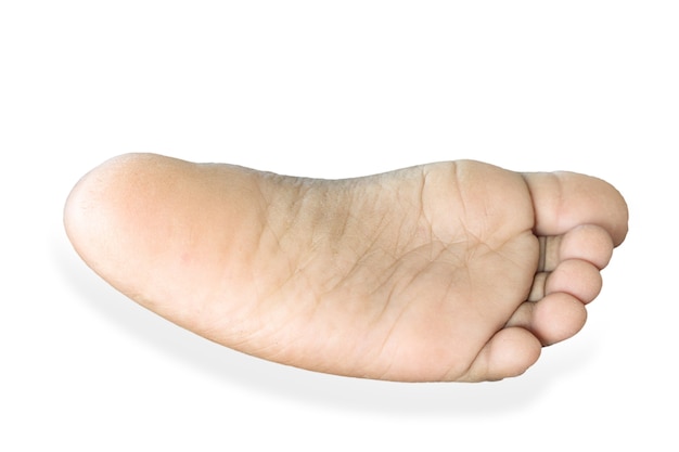 Foto droog en vuil een kind blote voeten op een witte achtergrond