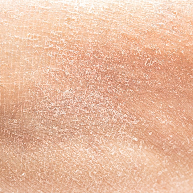 Photo dry human skin of a woman leg concept of skin rehydration cosmetics to keep the skin young