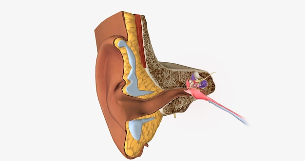 Earache is a general term for pain in the ear