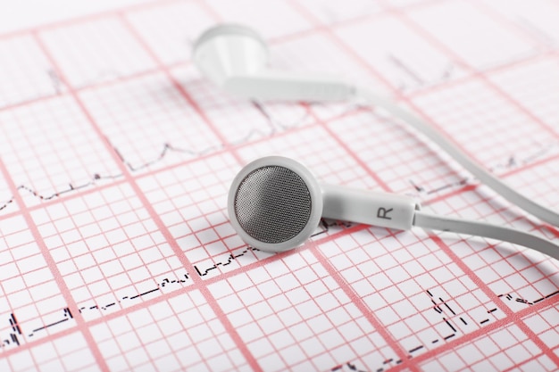 Photo earphones on cardiogram background