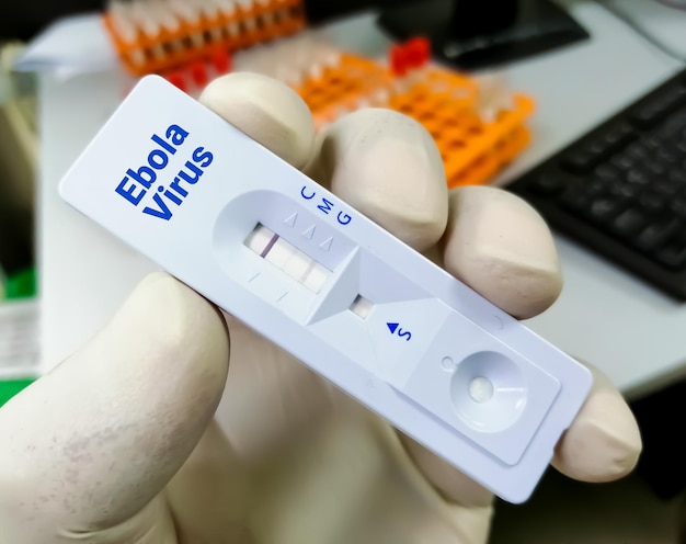 Foto virus ebola dispositivo per test di screening rapido