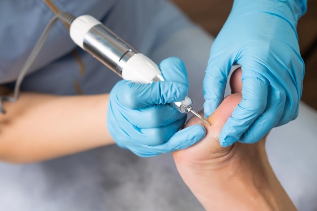 Foto een callus op de voet van een vrouw wordt verwijderd door een podoloog met behulp van een elektrische boor in de kliniek