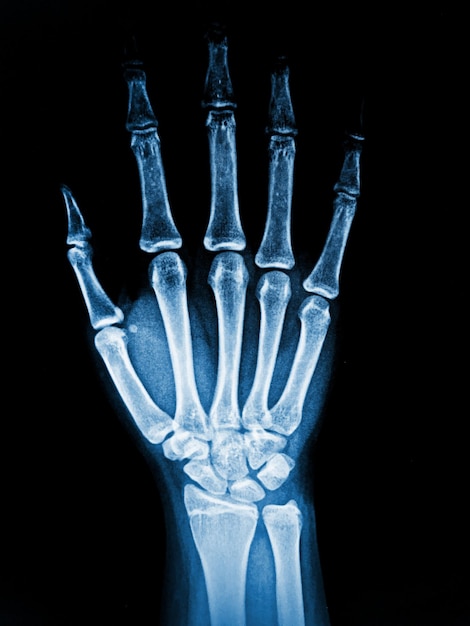 Foto een close-up van een hand met de polsbotten zichtbaar.