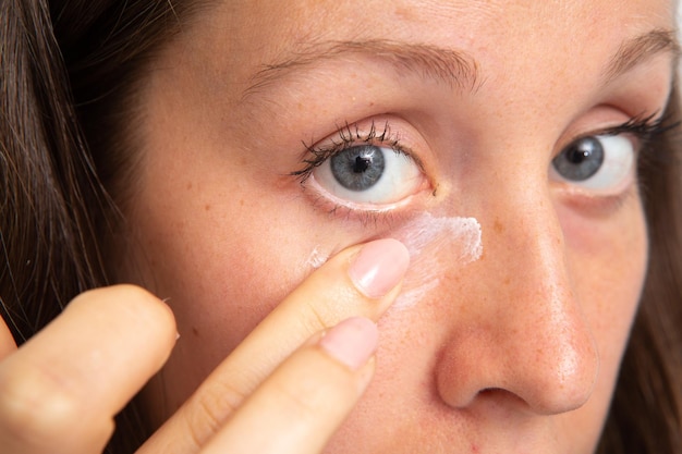 Een close-up zicht op het gezicht van een jonge blanke vrouw die crème aanbrengt op de tere huid onder haar blauwe ogen Hydraterende en huidverzorging