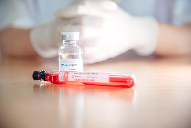 Een injectieflacon met vaccin en een bloedtestbuis met apenpokken