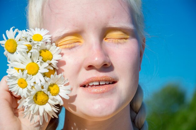 Een jonge albinovrouw in een gele blouse tegen een blauwe lucht.