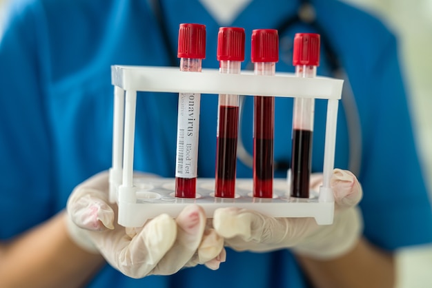 Een jonge verpleegster in uniform draagt reageerbuisjes met bloedmonsters naar het laboratorium. geneeskunde concept