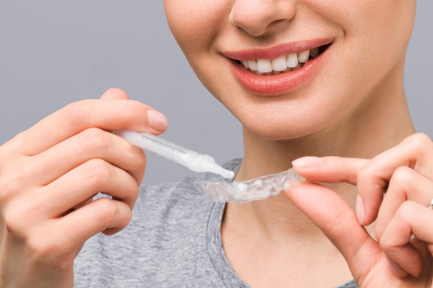 Een jonge vrouw doet een whitening tray voor het bleken van tanden thuis met gel