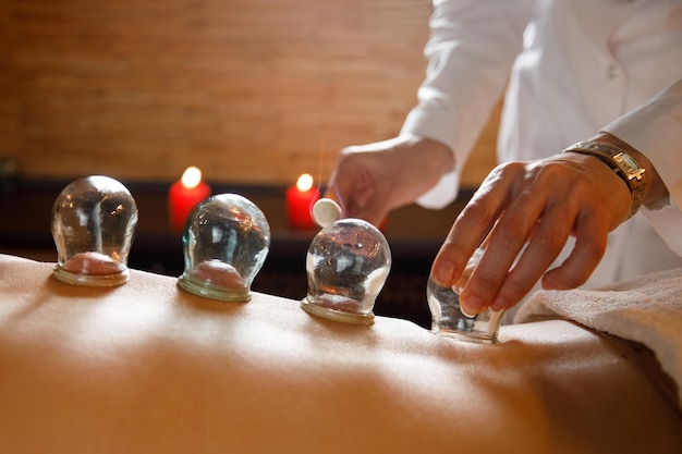 Een jonge vrouw ontspant in een massagesalon vacuüm kopjes medische cupping therapie op vrouw terug close