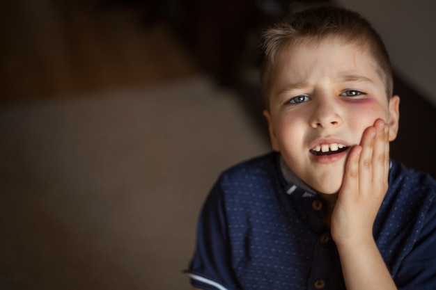 Een jongen met een blauw oog