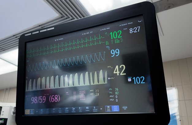 Een monitor met de woorden 'the heart rate' erop