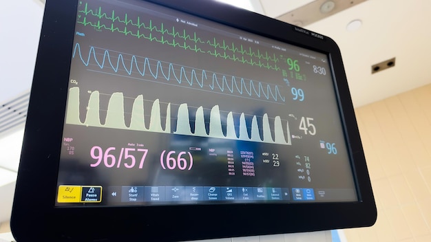 Een monitor met een hartslagscherm waar 95% op staat.