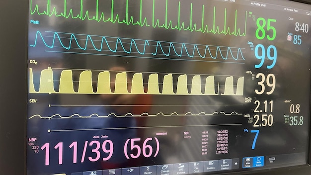 Een monitor met een roze display waarop '1 : 39' staat