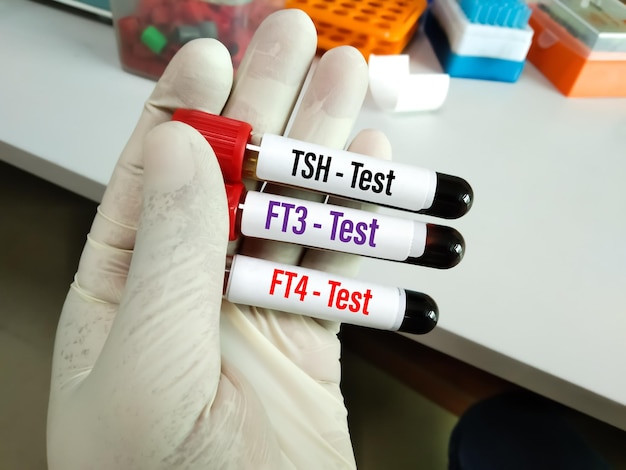 Een persoon houdt een reageerbuis vast waarop testtest staat.