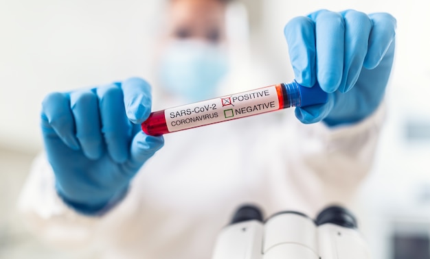 Een positieve coronavirus-test in handen gehouden door een laboratoriumpersoneel.