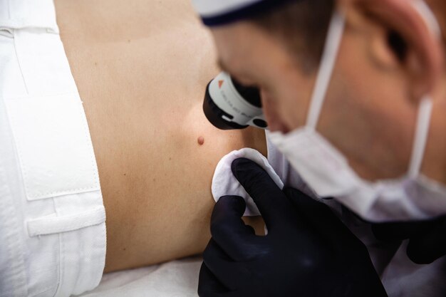 Een schoonheidsspecialiste met een witte pet en zwarte handschoenen onderzoekt een moedervlek op de rug van de patiënt met een dermatoscoop