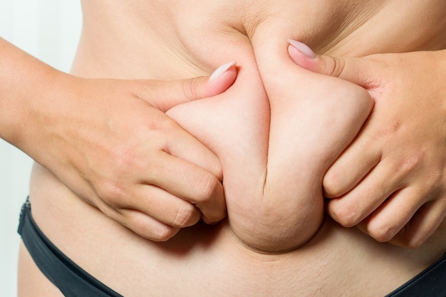 Een vrouw heeft een vetplooi om haar middel. conceptueel beeld van zwaarlijvigheid. close-up, geïsoleerd op een witte