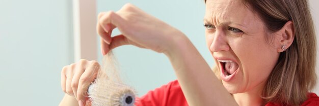 Een vrouw is geschokt door haaruitval op een kam close-up symptomen en behandeling alopecia kammen