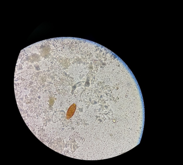 Фото Яйца trichuris trichiura (власоглав) в кале, анализ под микроскопом