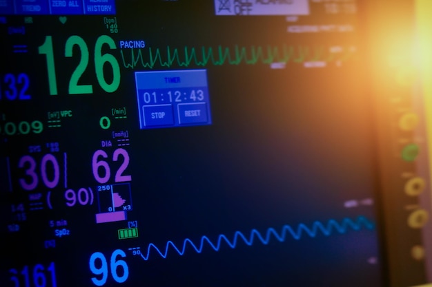 흐릿한 배경의 중환자실에서 대동맥 풍선 펌프 기계의 EKG 모니터 뇌파 심박수 파동