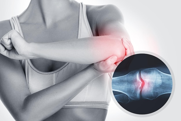 Elbow and and Xray effect with an injured joint