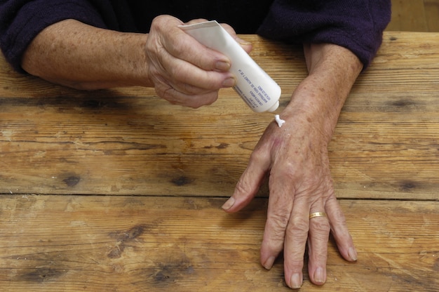 Elderly woman putting on ointment