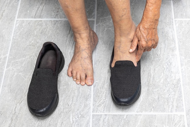 写真 年配の女性の静脈瘤の足が家で靴を履く
