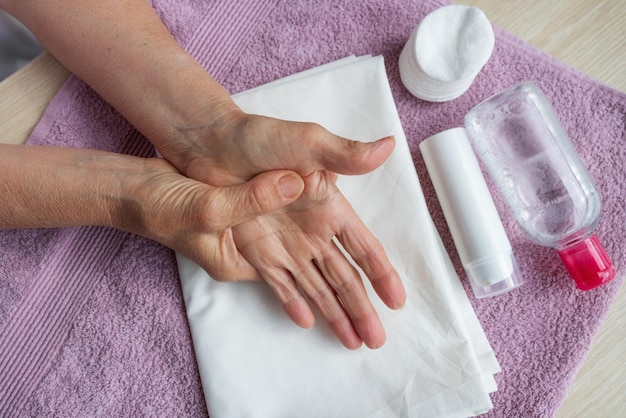 An elderly woman with arthritis makes herself a hand massage uses a cream