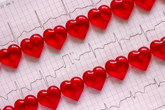 Electrocardiogram and red hearts.