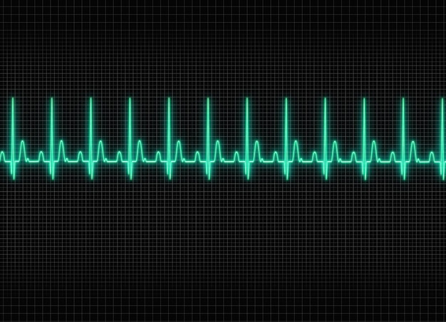 Photo electrocardiography