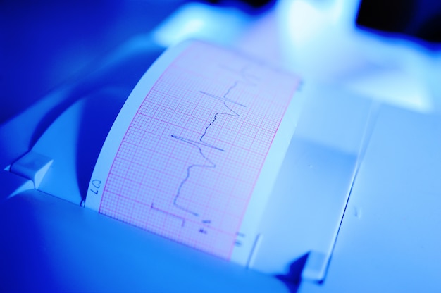 Elektrocardiogram in verpleegster overhandigt close-up