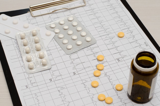 Elektrocardiogram op papier. Tabletten liggen op een ECG