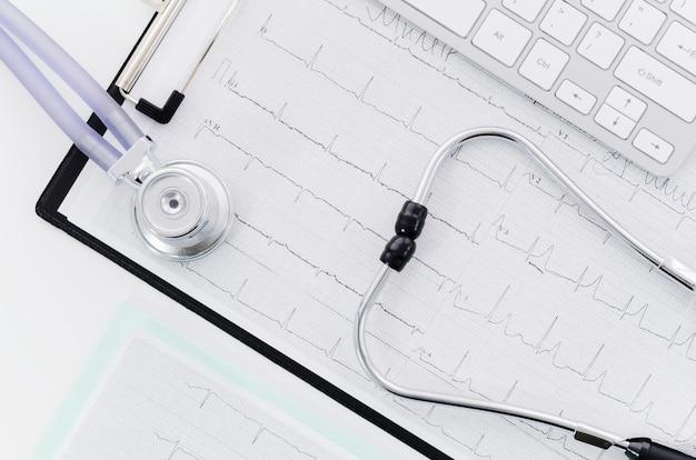An elevated view of stethoscope over the medical ecg report near the keyboard