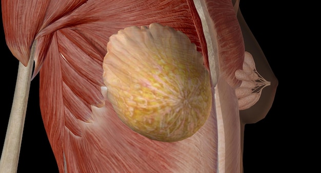 Elke borst heeft een aantal secties lobules die uit de tepel vertakken