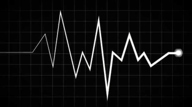 Foto monitoraggio ecg di emergenza linea del battito cardiaco tracciato del polso e grafico ecg battito cardiaco in bagliore al neon bianco il battito cardiaco elettrocardiogramma