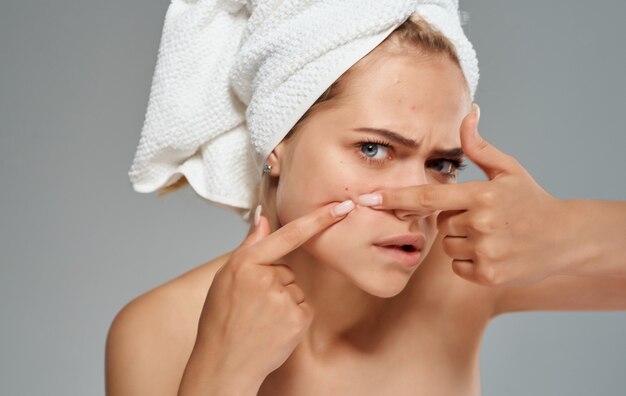 Emotional woman with a towel on her head squeezes out pimples\
on her face on a gray background