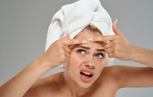 Emotional woman with a towel on her head squeezes out pimples\
on her face on a gray wall.