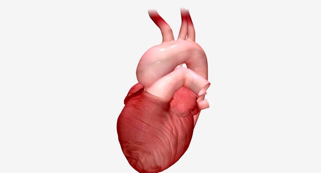 Photo the enlarged portion of the aortic arch is replaced with a synthetic graft