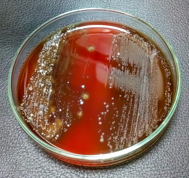 Фото Колония энтеробактерий на кровяном агаре