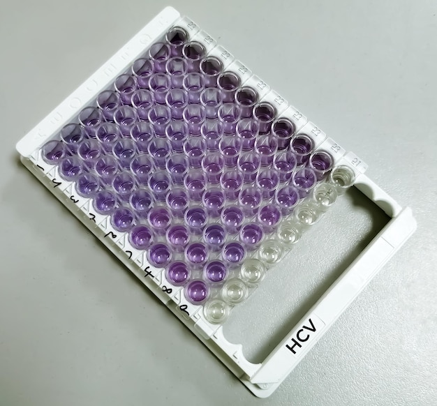Foto test di immunoassorbimento enzimatico o piastra elisa per il test dell'epatite c