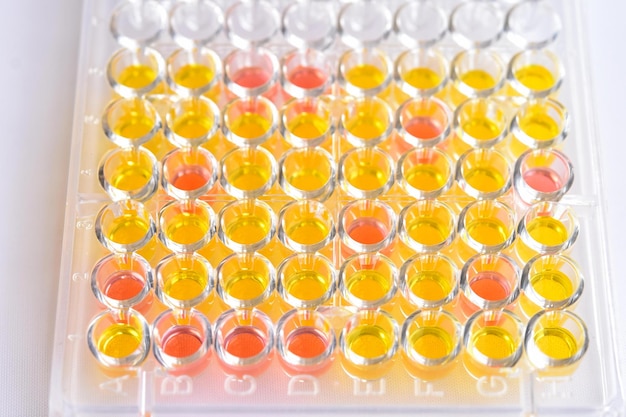 Enzymelinked immunosorbent assay or elisa plate immunology testing method in medical laboratory