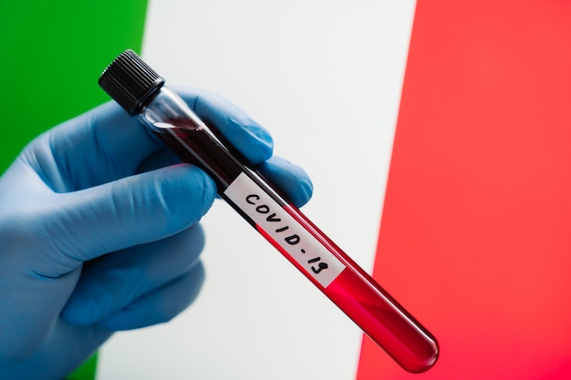 Epidemic alert. Coronavirus outbreak in Italy. Test blood sample in hand wearing medical gloves against Italian flag. Health worker holds test tube